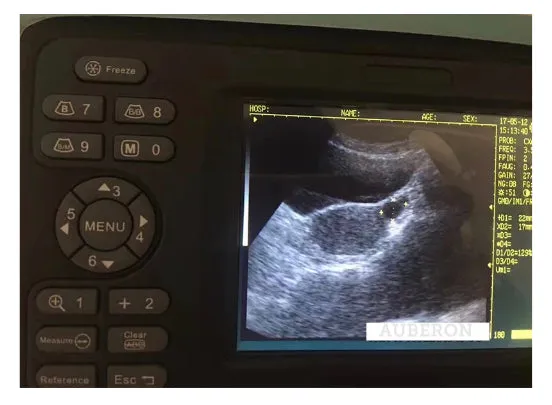 SALE! Veterinary Ultrasound Machine Portable Lightweight Handheld $2049 incl Convex Probe